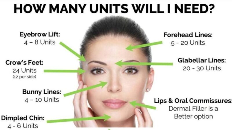 Botox & Fillers